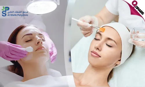 Instant Glow: Chemical Peel for Ladies & Men at Al Shefa Polyclinic!